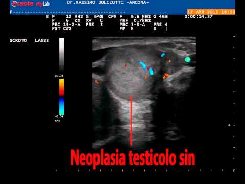 Aumentare la lunghezza del pene Come migliorare la potenza