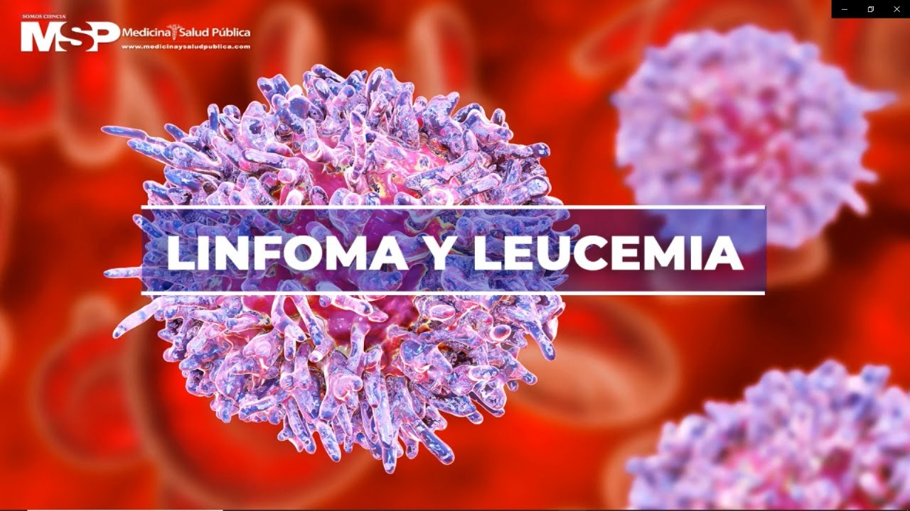 Watch Dr. Alexis Cruz Chacón Linfoma y leucemia Now Dr. Alexis Cruz Chacón Linfoma y leucemia