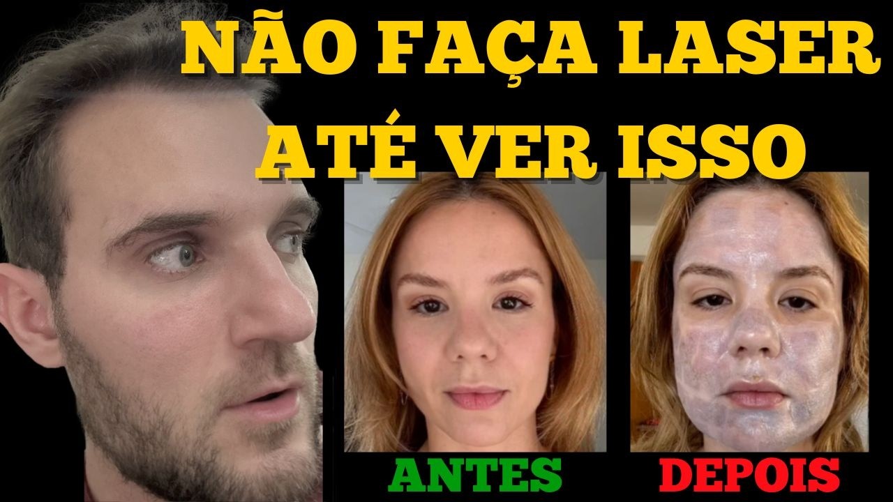 Burned your face with CO2 laser? Dermatologist explains