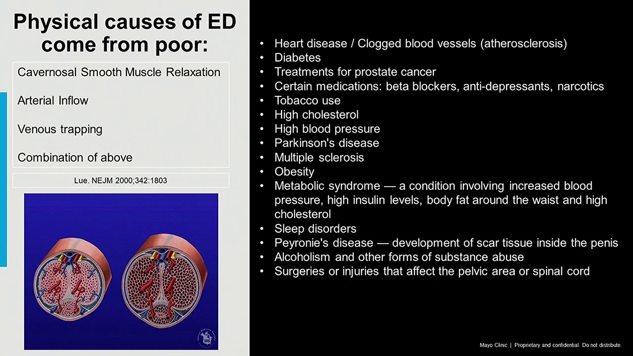 Mayo Men's Health Moment: Erectile Dysfunction (ED) Risk Factors