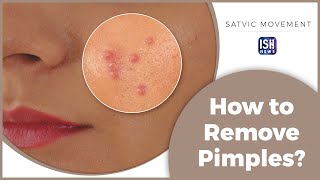 How to Remove Pimples Naturally! #IndianSignLanguage #SatvicMovement