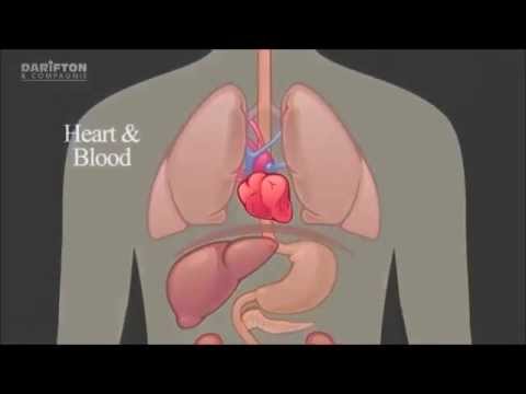 comment soigner hypertension