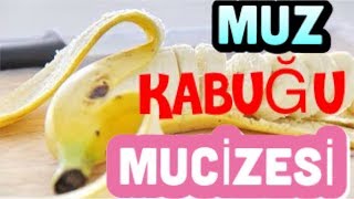 MUZ KABUKLARIYLA HAYATINIZI KOLAYLAŞTIRACAK İLGİNÇ BİLGİLER!!!