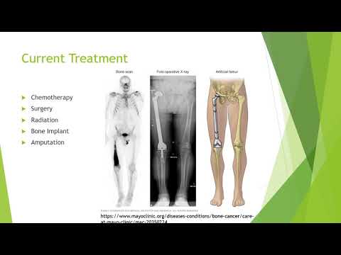Bone Cancer Presentation BIO549