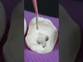 Satisfying Root Canal And Crown Process Shorts