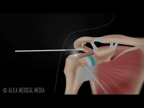 Overview of the Musculoskeletal System Animation