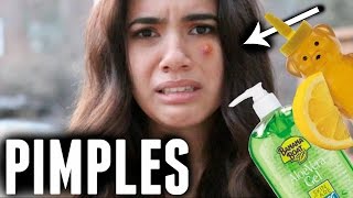 25 WEIRD WAYS TO GET RID OF ACNE/PIMPLES OVERNIGHT!!