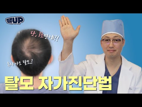 [털업UP!]탈모자가진단ㅣ남성탈모, 여성탈모ㅣ탈모의심될땐?!ㅣ모모성형외과ㅣ고상진원장님