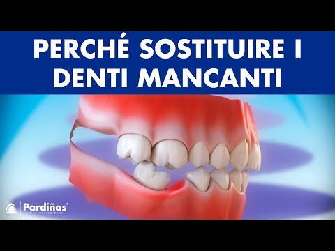 Quanto tempo una risonanza magnetica della toracica Mal di schiena e intorpidimento talloni