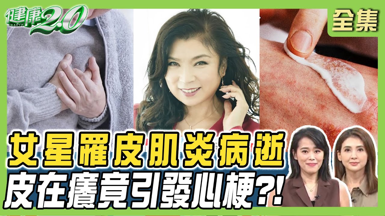 皮膚1症狀小心!2女星全驟逝 她「罹病才2個月」得年19歲