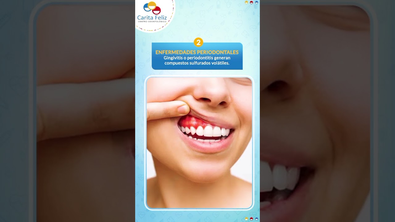 Angela Canales Larrea-56