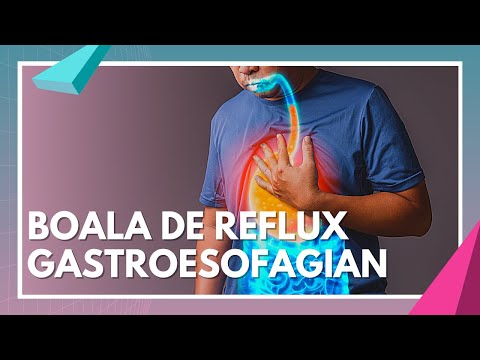 , title : 'Boala de reflux gastroesofagian | Simptome, Cauze și Tratament | dr. Cristian Costea'