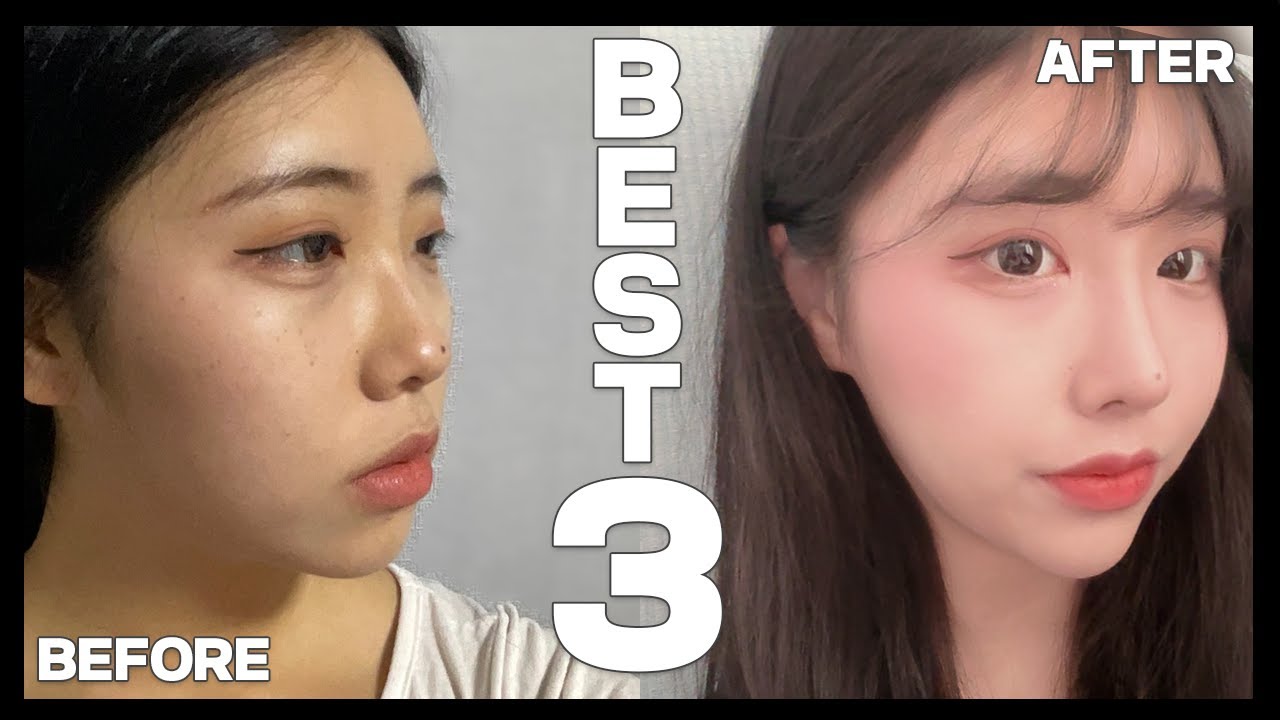 결과만 딱 보여주는 BEST 3 #성형후기 #코성형전후 #성형전후