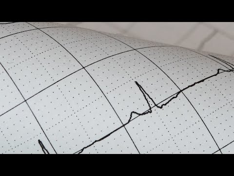 Smedex Trailer - EKG Herz, Rhythmus & Störung - Sinusrhythmen - E-Learning Rettungsdienst & Medizin