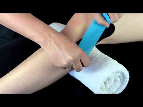 Symptome einer Ruptur des Kreuzbandes Knie Arthrose des Kniegelenks 2 EL. Behandlung