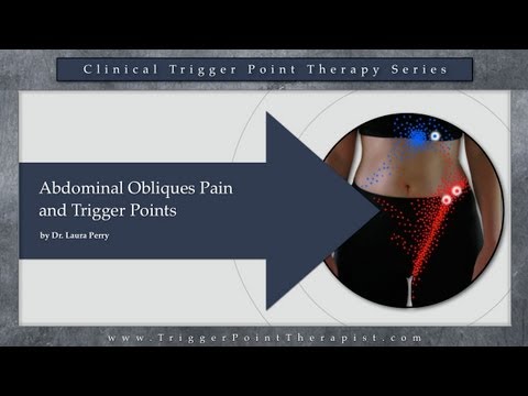 Abdominal Oblique Pain and Trigger Points