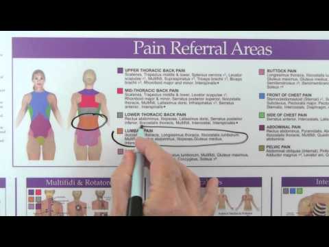 Spine, Thorax and Abdomen Trigger Point Wall Chart