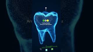 Implantología dental en San Juan de Alicante