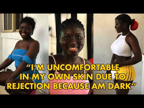 I’m uncomfortable in my own skin due to rejection because am dark