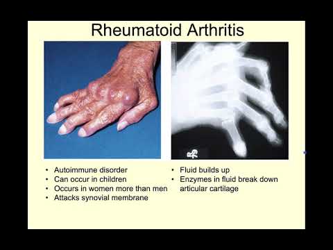 NAU Bio 201 Lab 5 – Articulations