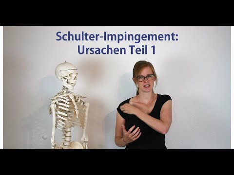 Schulterschmerzen? Ursachen für das Impingement Syndrom? [Teil 1] 💃