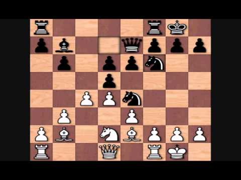 Johannes Zukertort's Immortal Game
