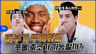 피부가 두껍두껍하면 '콧볼 축소'가 불가능하다❓