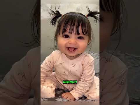 L'incredibile trasformazione di questa bambina ti scioglierà il cuore ❤️.#shorts #viral #viralvideo