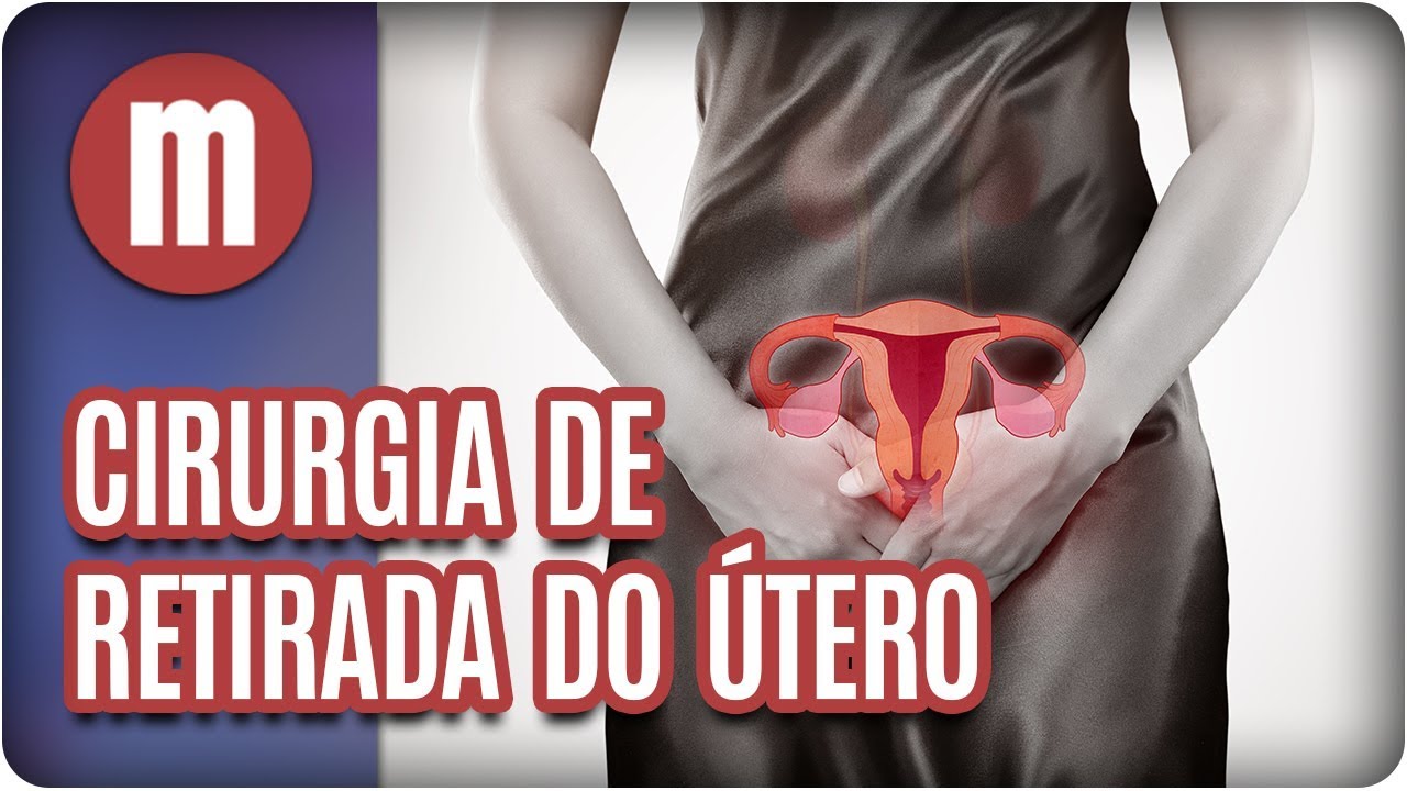 Cirurgia de retirada do útero - Mulheres (29/01/18)