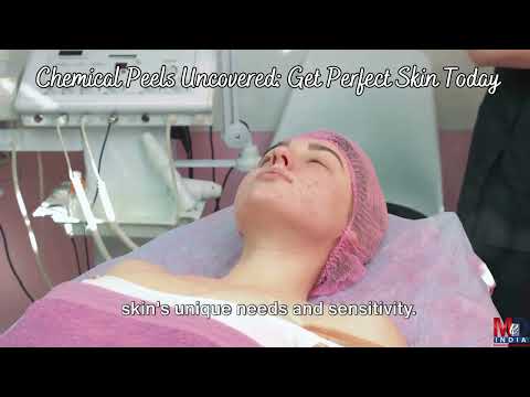 Chemical Peel For a Perfect Skin: Your Guide to Latest Skin Treatments