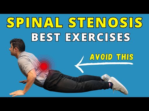 Best Exercises for Spinal Canal Stenosis Pain Relief