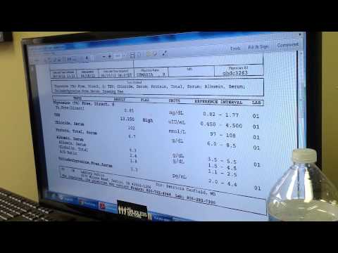 TSH, T3, T4 Exam: Explaining Results