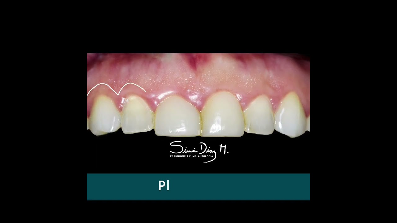 Simón Díaz Miranda-4