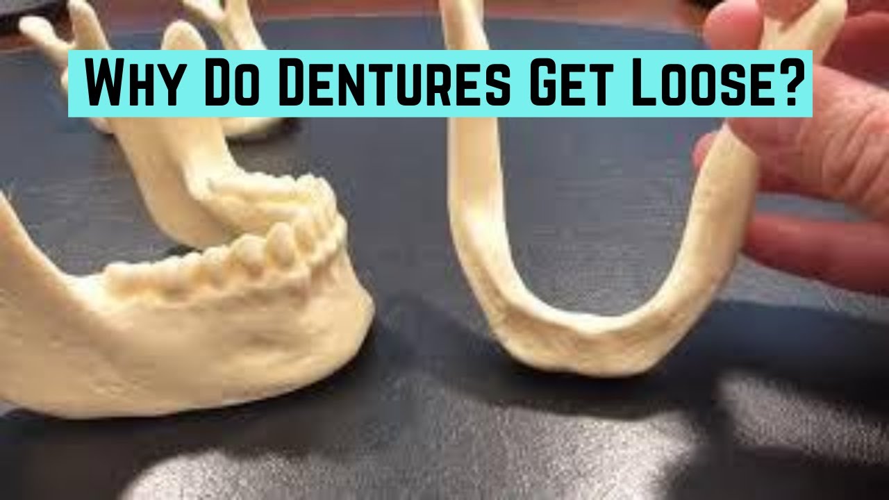 Why do dentures get looser over time?