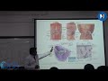 CLINICAL ANATOMY OF SPLEEN THROUGH CASES I 1ST MBBS IN PRC I DR P HARINATH I 2012