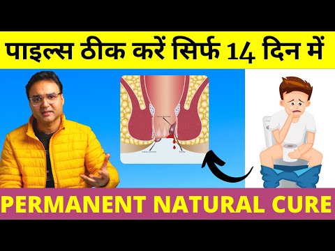 Piles Treatment: पुराने से पुराना पाइल्स (बवासीर) 14  दिन में जड़ से ठीक करें | Piles Home Treatment