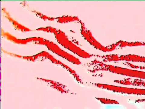 STEREOSKOP - Forget me not