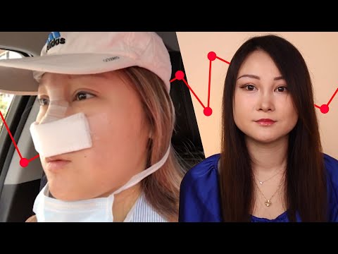 私は整形手術を受けたと私はそれを後悔しています。 (I Got Plastic Surgery And I Regret It)
