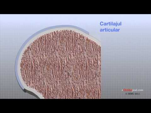 Comprese de tratament articular