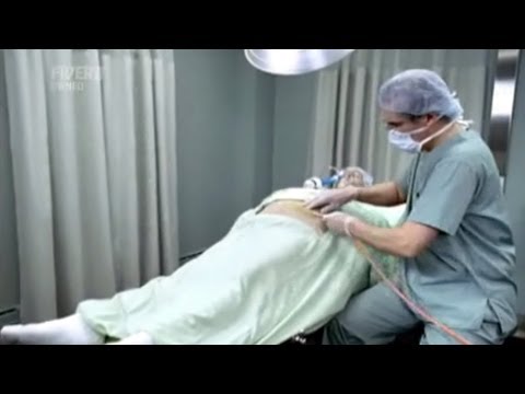 Kung paano mapupuksa ang taba at cellulite sa cabin Nabawasan ako ng timbang sa pamamagitan ng araw
