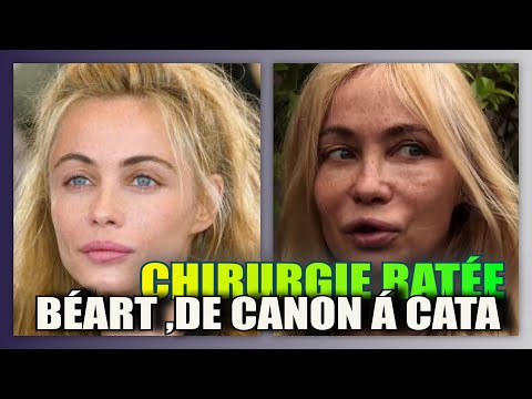 Emmanuelle Béart a gaché sa beauté avec la chirurgie esthétique ratée. Quelle gachis...