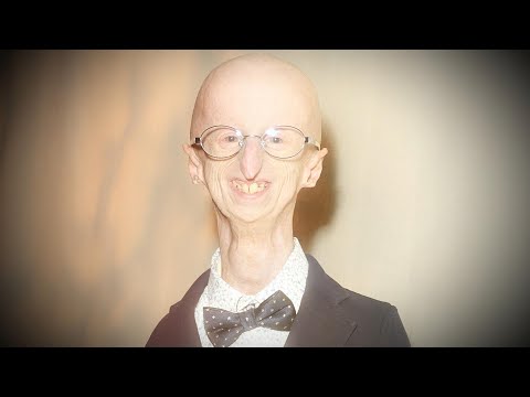 Sammy Basso, Oldest Living Person With Progeria, Dies at 28