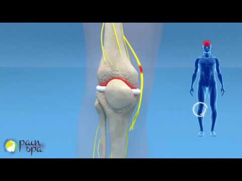 COOLIEF: Genicular nerve block and radiofrequency of the Knee Joint