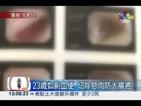 癌症不是老人病! 1/3可預防