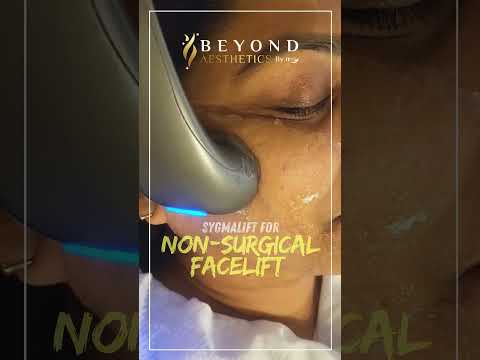 Sygmalift for Non Surgical Facelift Beyond Aesthetics 