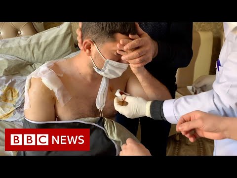 戰爭後的生活:"太痛苦了,無法入睡"--BBC新聞。 (Life after war: 'It's too painful to sleep' - BBC News)