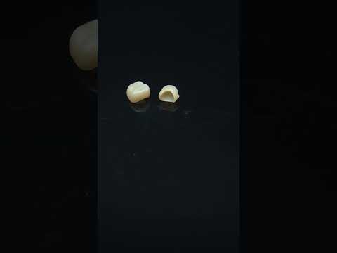YouTube 썸네일