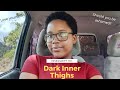 INSECURITY 101 Dark Inner Thighs