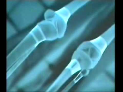 Te mendosh thell [ Dokumentar Shqip ]