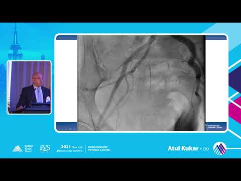 Perforation - Atul Kukar, DO